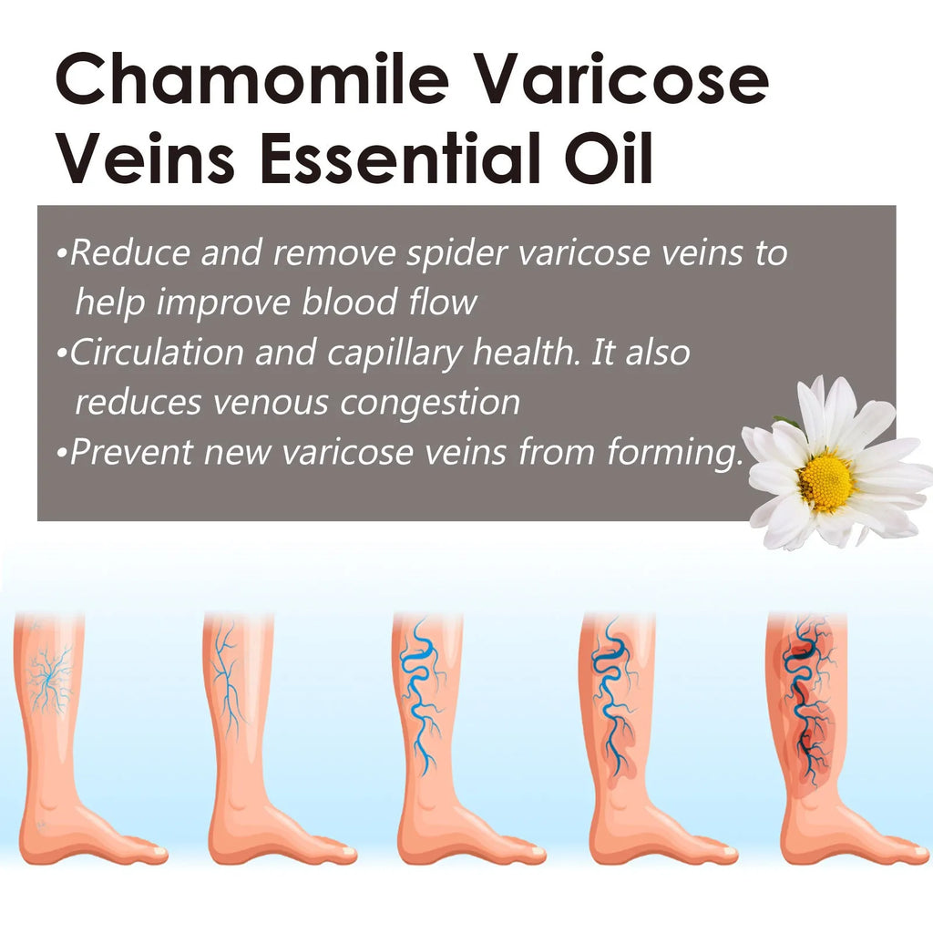 10ml bottle of chamomile essential oil for leg care and massage