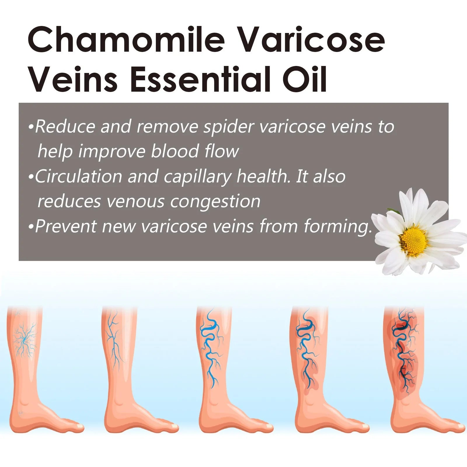 10ml bottle of chamomile essential oil for leg care and massage