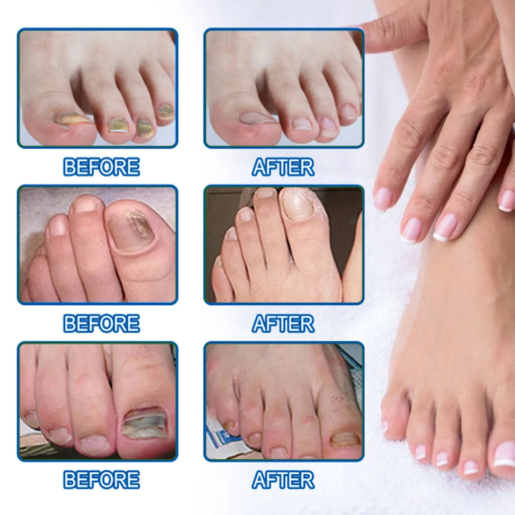 Nail nursing adhesive bandage repair patches box containing 32 patches measuring 6.1x3.5cm