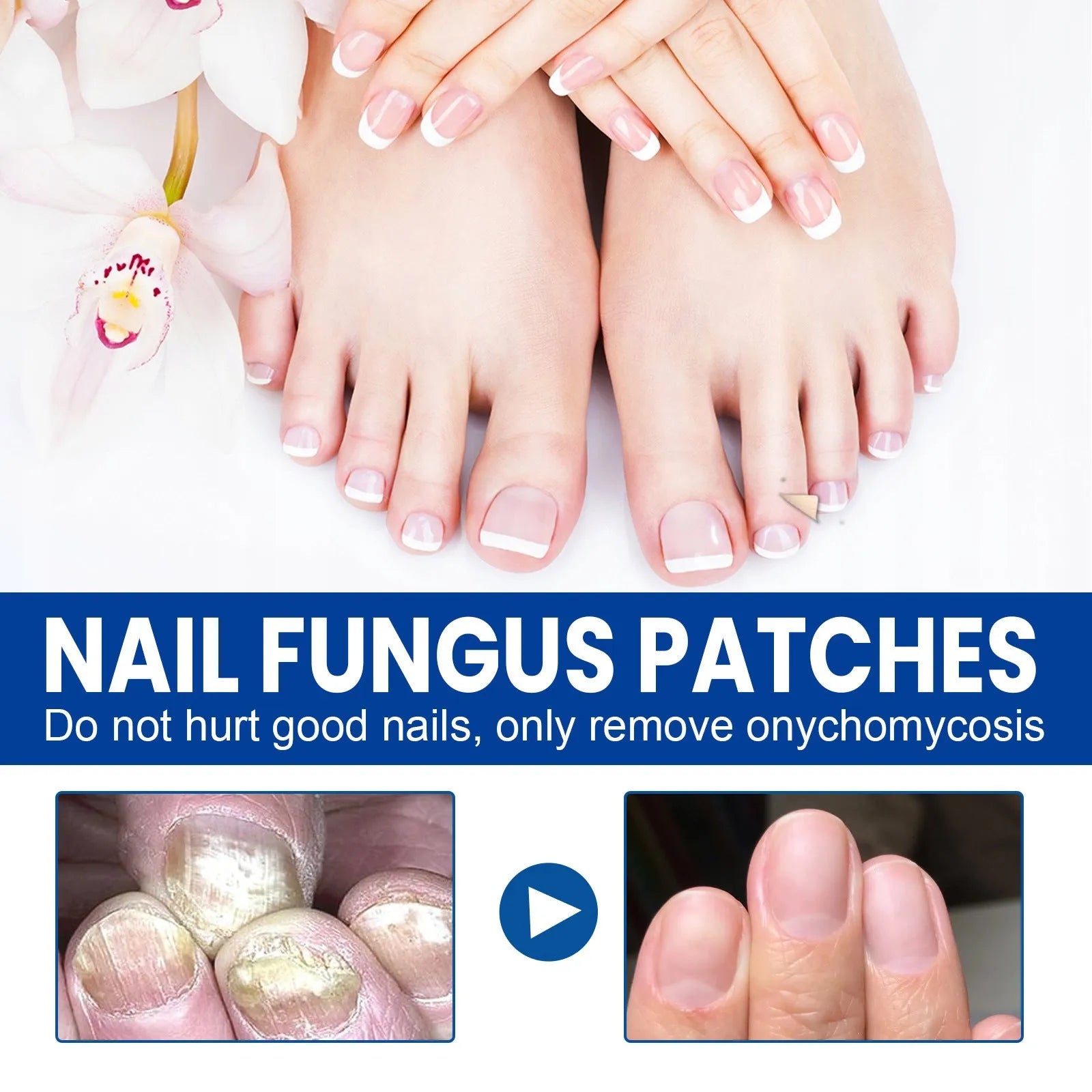 Nail nursing adhesive bandage repair patches box containing 32 patches measuring 6.1x3.5cm
