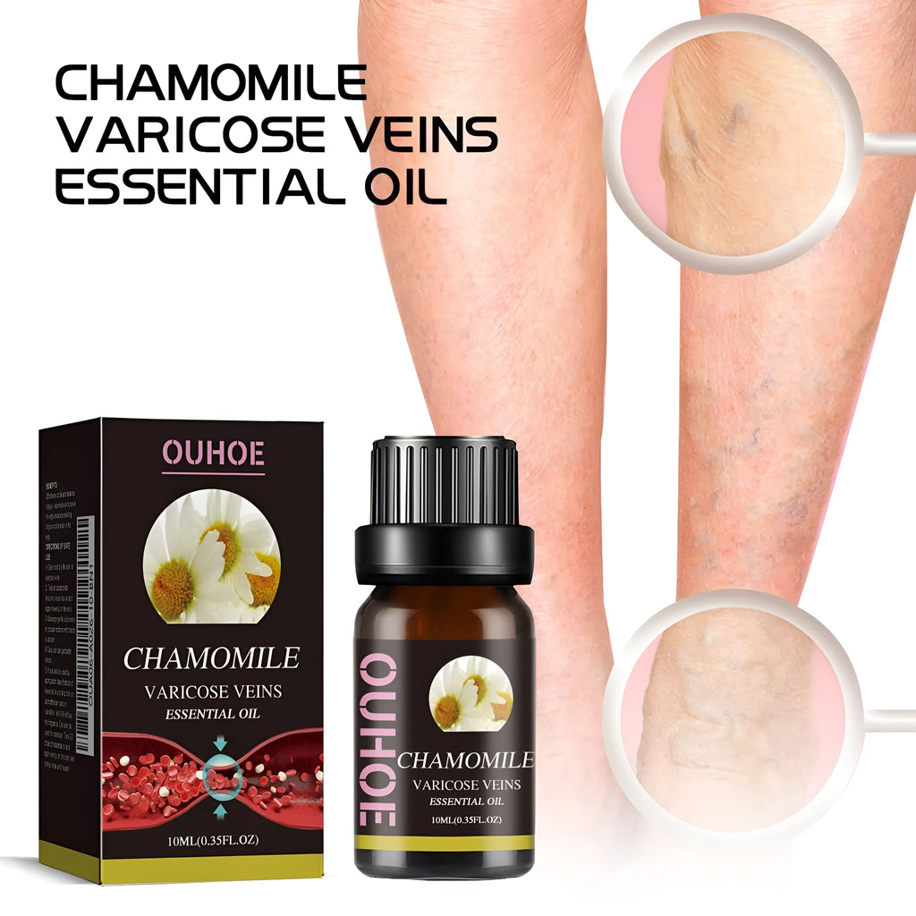 10ml bottle of chamomile essential oil for leg care and massage