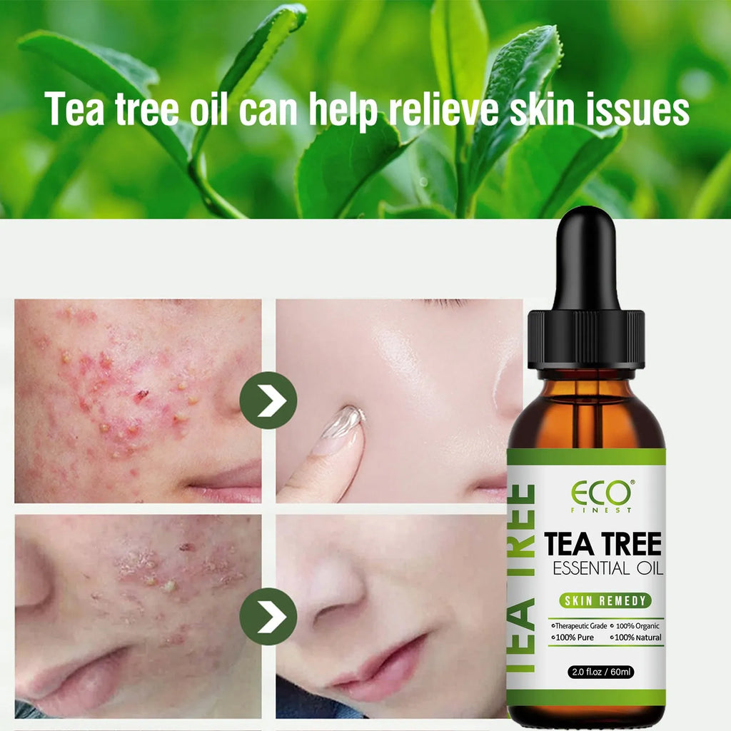 60ml bottle of tea tree essential oil for acne and massage use.