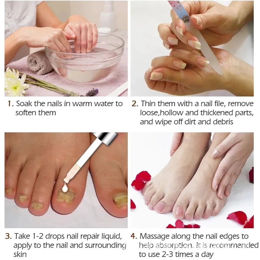 Jiagou 10ml antimicrobial foot treatment liquid bottle for whitening and antibacterial nail care