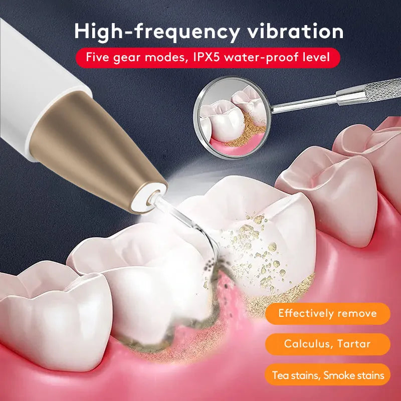 Gold-coloured ultrasonic tooth cleaning device for tartar and stain removal