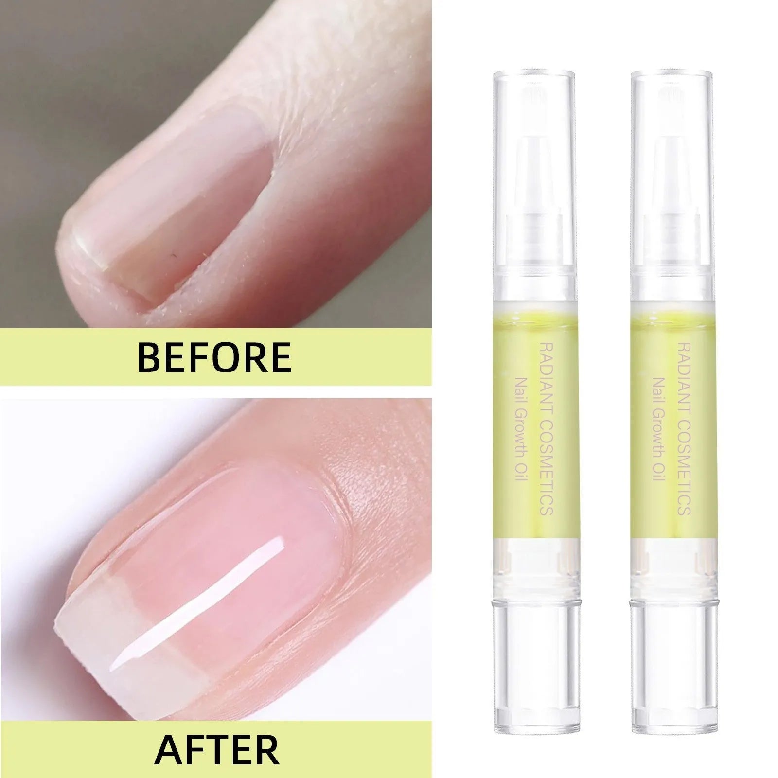 3ml nail growth treatment oil bottle for promoting healthy nails with wash-free application