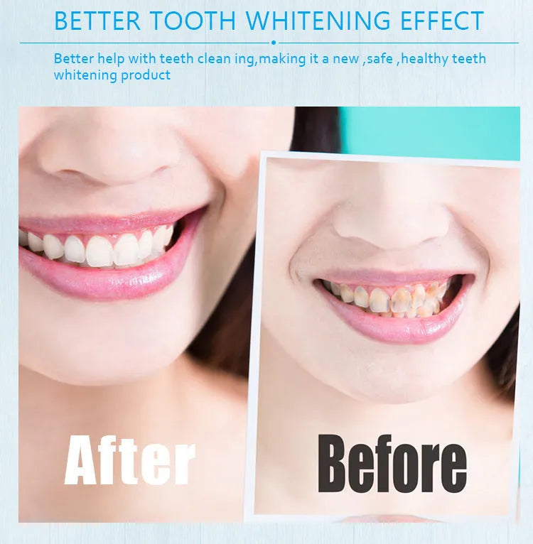 Teeth whitening pen in gold aluminium case for adult teeth cleaning gel application.
