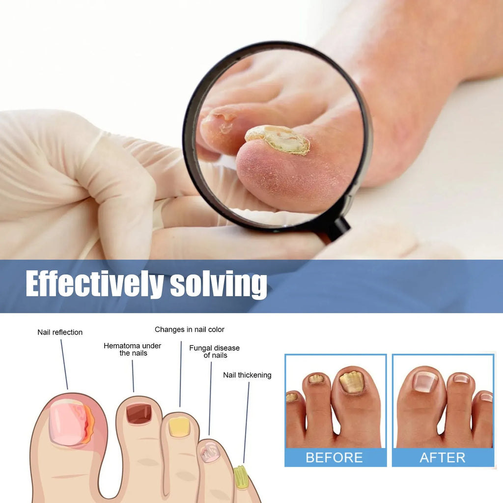 Nail nursing adhesive bandage repair patches box containing 32 patches measuring 6.1x3.5cm
