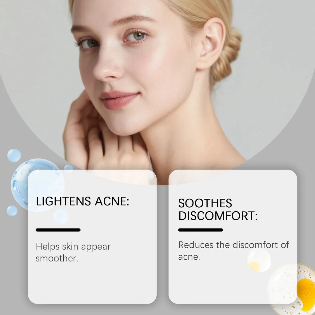 Package of 80 hydrocolloid acne patches for facial blemish treatment