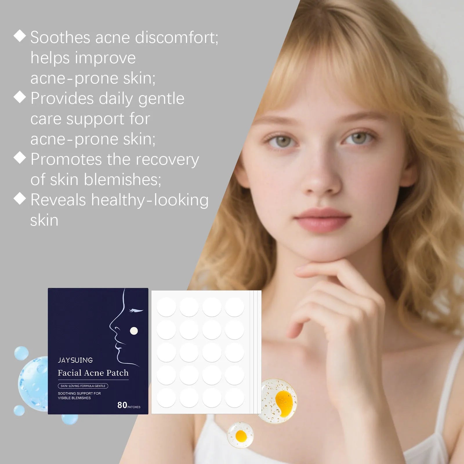 Package of 80 hydrocolloid acne patches for facial blemish treatment