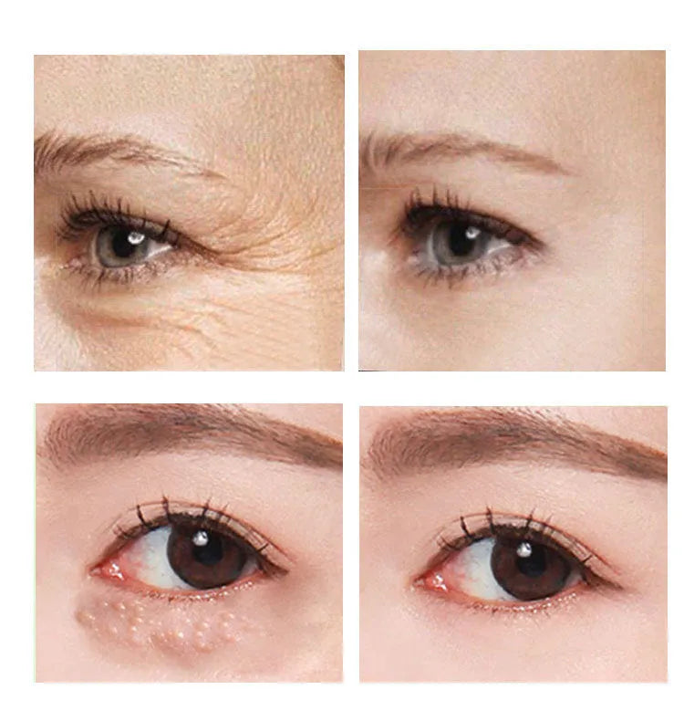 Beauty Eye Cream 30ml jar for women's eye area skincare