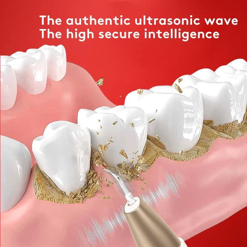 Gold-coloured ultrasonic tooth cleaning device for tartar and stain removal